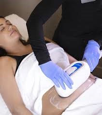 CoolSculpting procedure being performed on a woman's thigh for cellulite treatment in Fairfield, CT